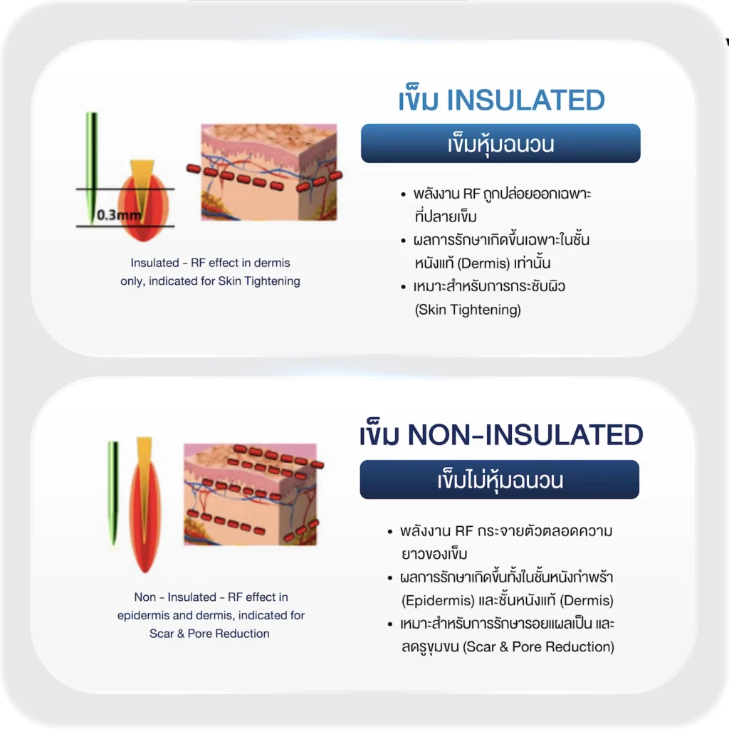โครงสร้าง และการทำงานเครื่อง Micro Needle RF