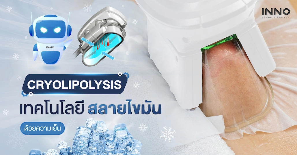 "Cryolipolysis" เทคโนโลยี สลายไขมัน ด้วยความเย็น