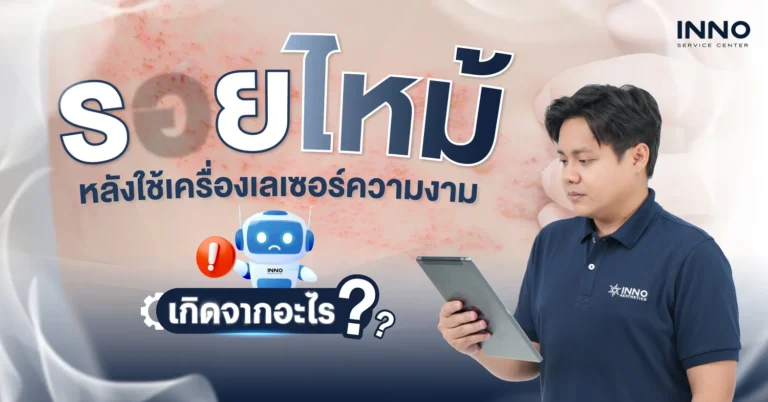 รอยไหม้หลังใช้เครื่องเลเซอร์ความงาม เกิดจากอะไร