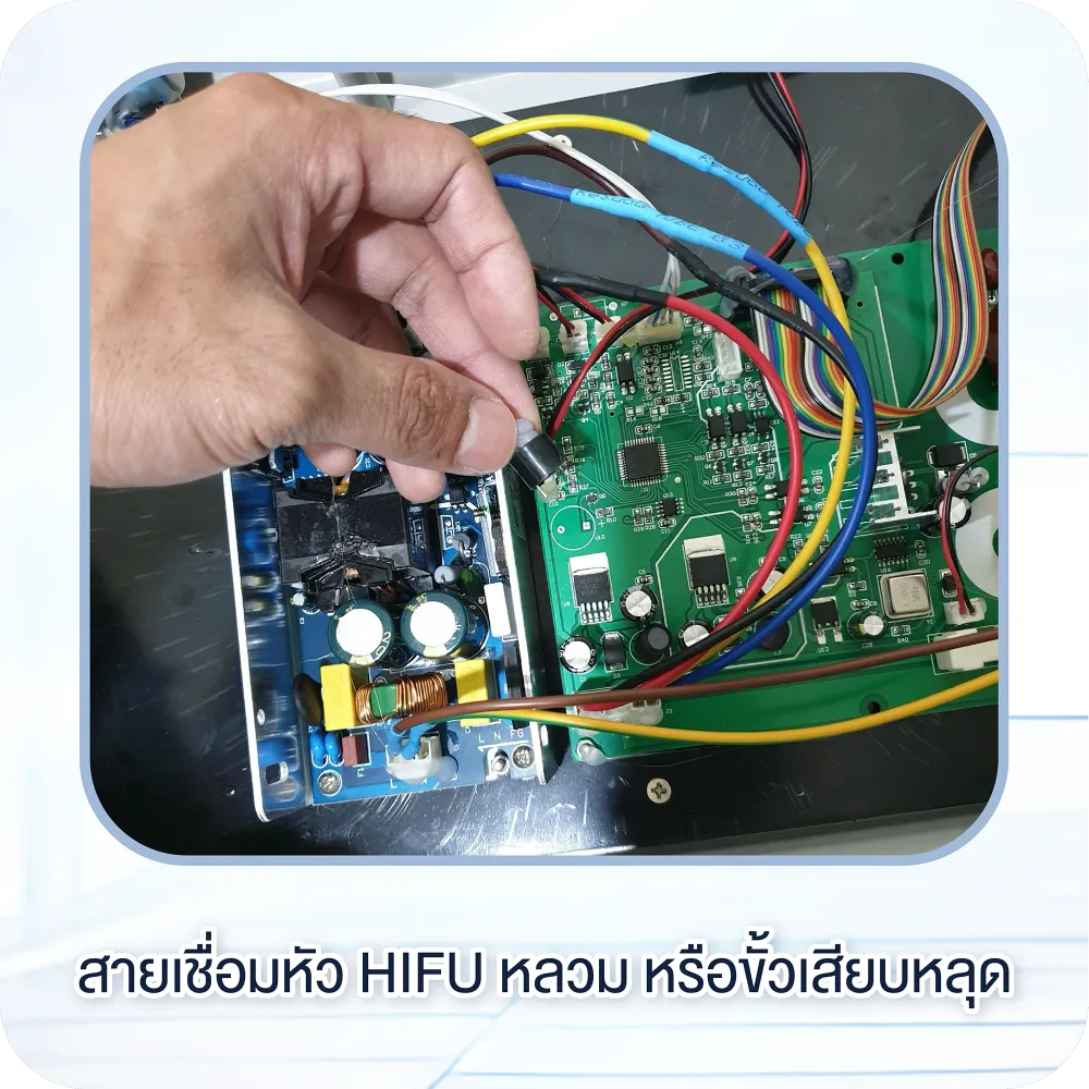 สายเชื่อมหัว HIFU หลวม หรือขั้วเสียบหลุด