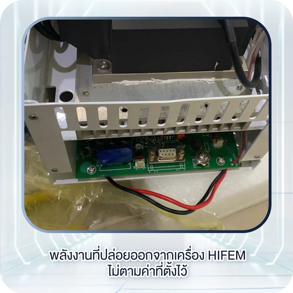 พลังงานที่ปล่อยออกจากเครื่อง HIFEM ไม่ตามค่าที่ตั้งไว้