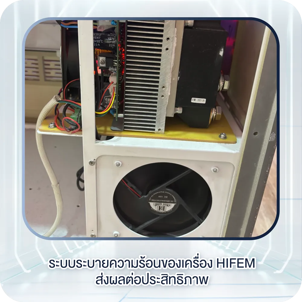 ระบบระบายความร้อนของเครื่อง HIFEM ส่งผลต่อประสิทธิภาพ