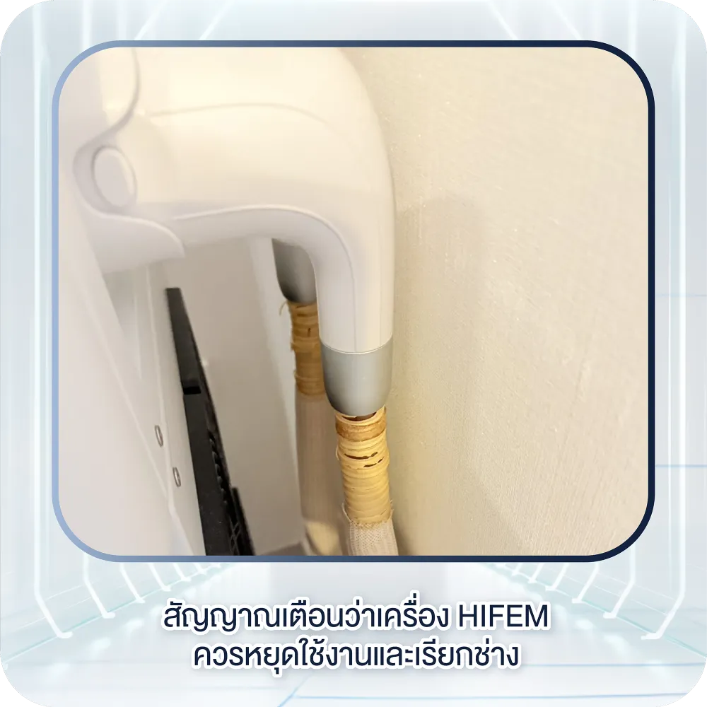 สัญญาณเตือนว่าเครื่อง HIFEM ควรหยุดใช้งานและเรียกช่าง