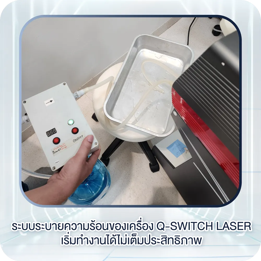 ระบบระบายความร้อนของเครื่อง Q-Switch Laser เริ่มทำงานได้ไม่เต็มประสิทธิภาพ
