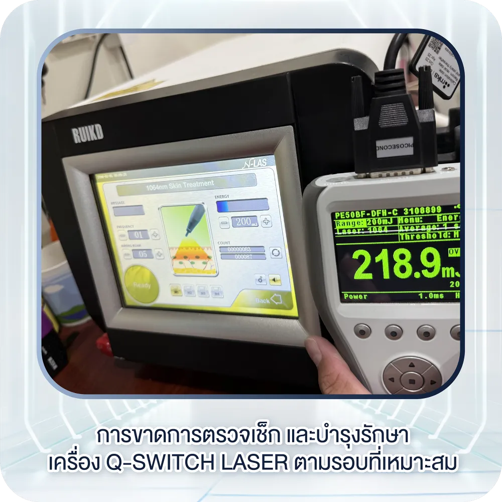 การขาดการตรวจเช็กและบำรุงรักษาเครื่อง Q-Switch Laser ตามรอบที่เหมาะสม