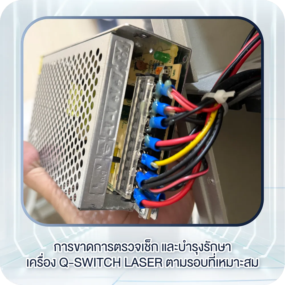 การขาดการตรวจเช็กและบำรุงรักษาเครื่อง Q-Switch Laser ตามรอบที่เหมาะสม