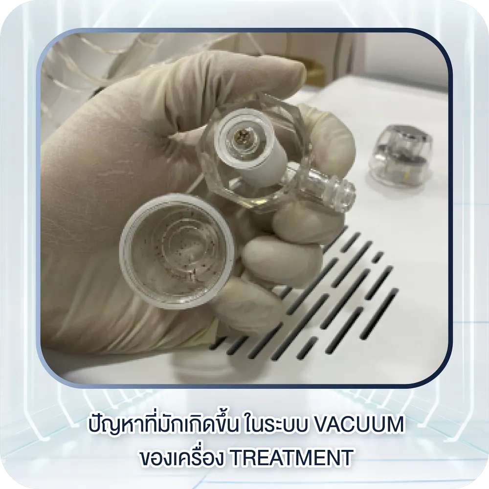 ปัญหาที่มักเกิดขึ้น ในระบบ Vacuum ของเครื่อง Treatment