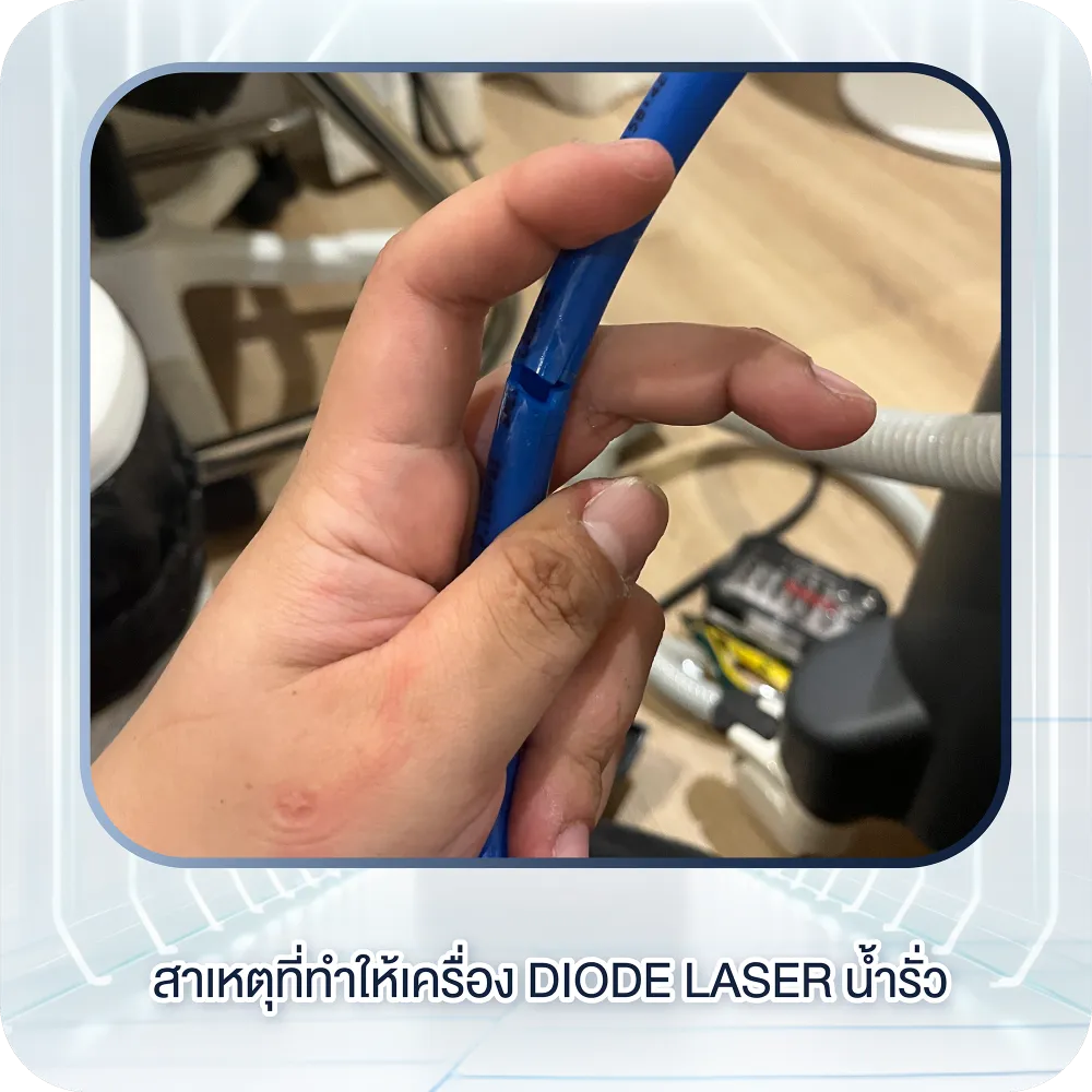 สาเหตุที่ทำให้เครื่อง Diode Laser น้ำรั่ว